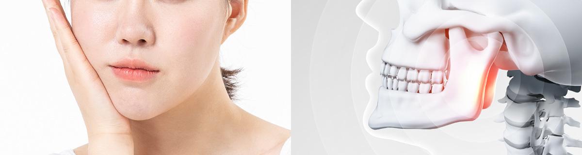 Best of Braces facial comp
