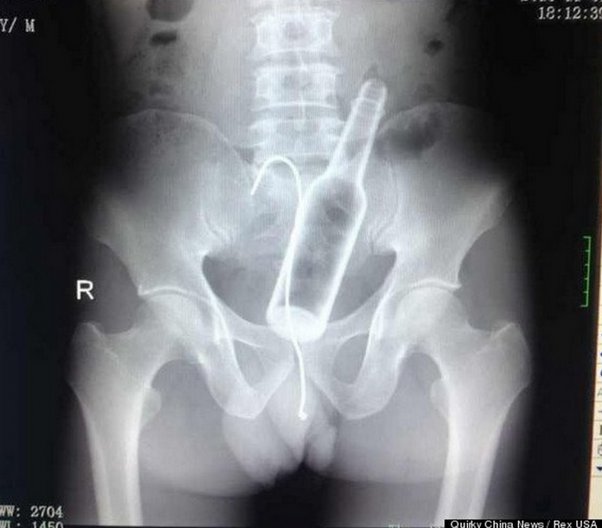 Best of Ass finger