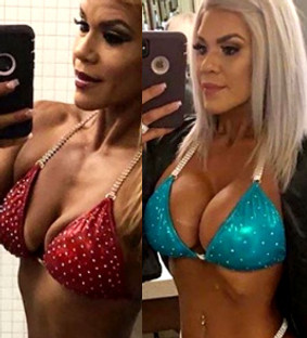 d winston scaife recommends Porn Stars With Penile Implants