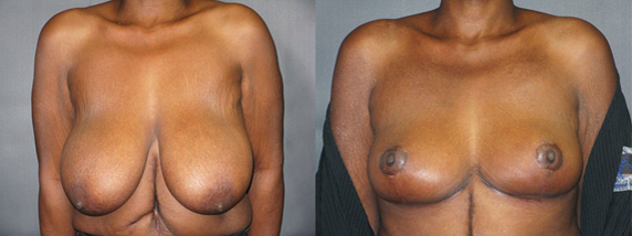 brittany northrup recommends 38d Tits