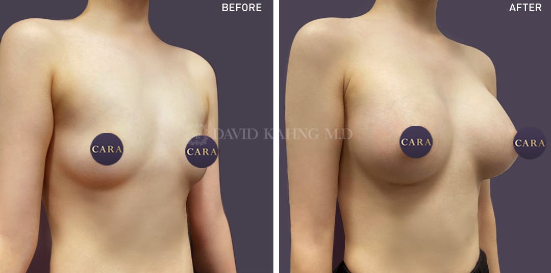 Best Asian Titties broken bbc dawn hensley recommends Best Asian Titties