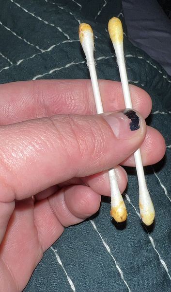 carmen ingram like ear wax fetish photo channing ross recommends ear wax fetish pic