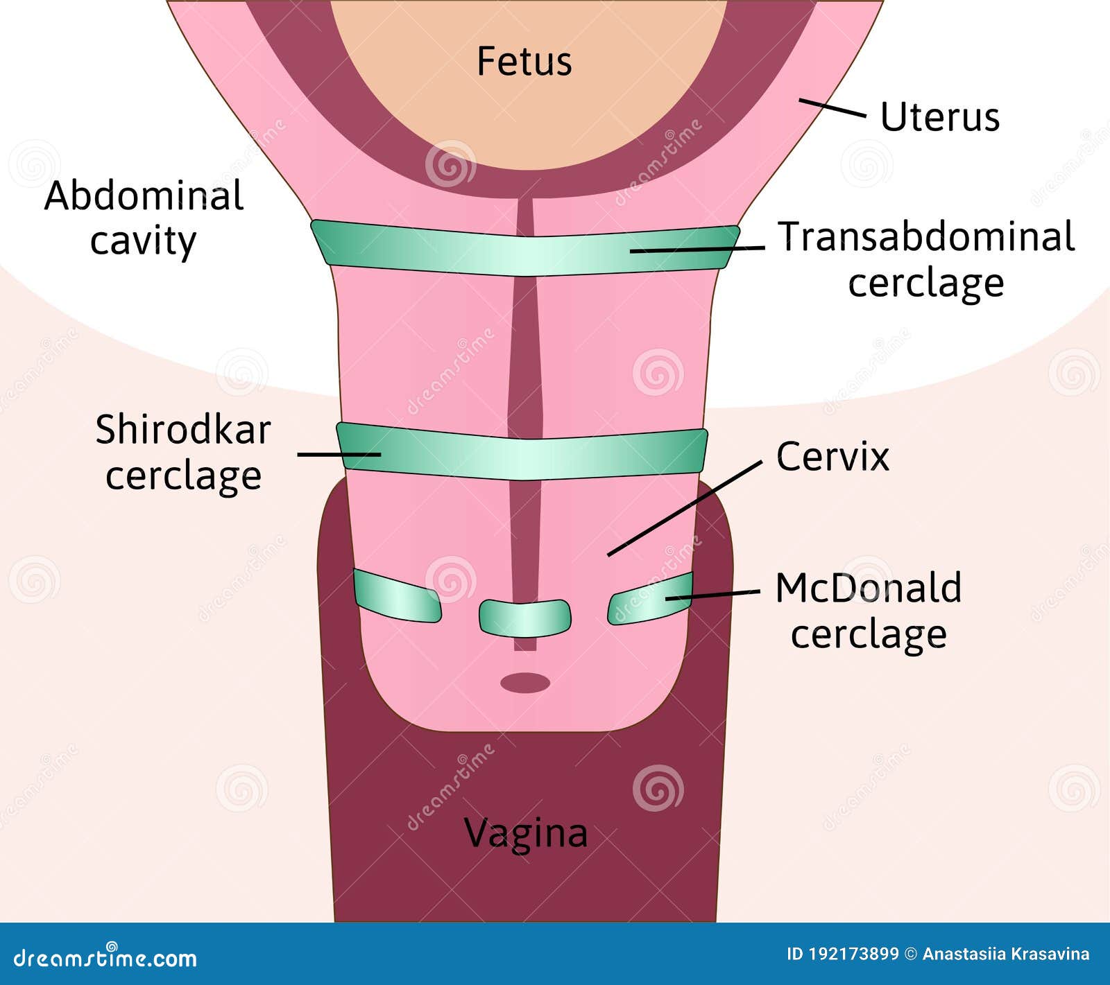 cervix fucking - megan guthrie porn petra vervaik