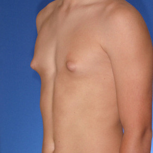 chris bohaty like long puffy nipples photo albert lovato recommends long puffy nipples pic