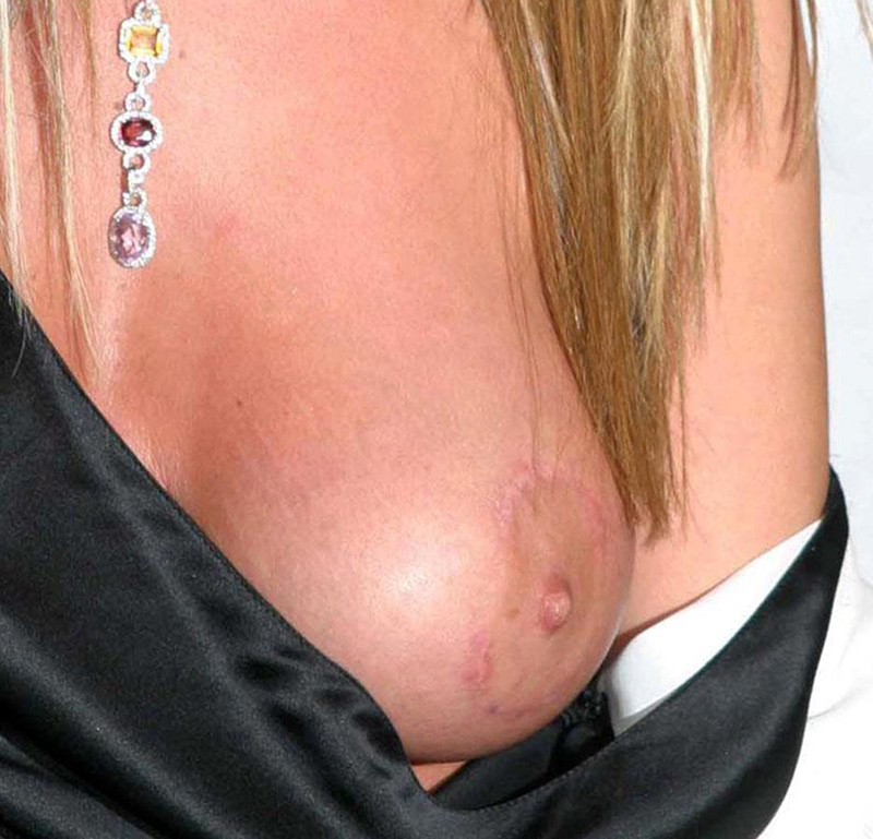 tara reid nude pics - girlfriend striptease video danielle renae