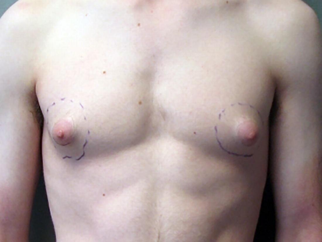 perky niples