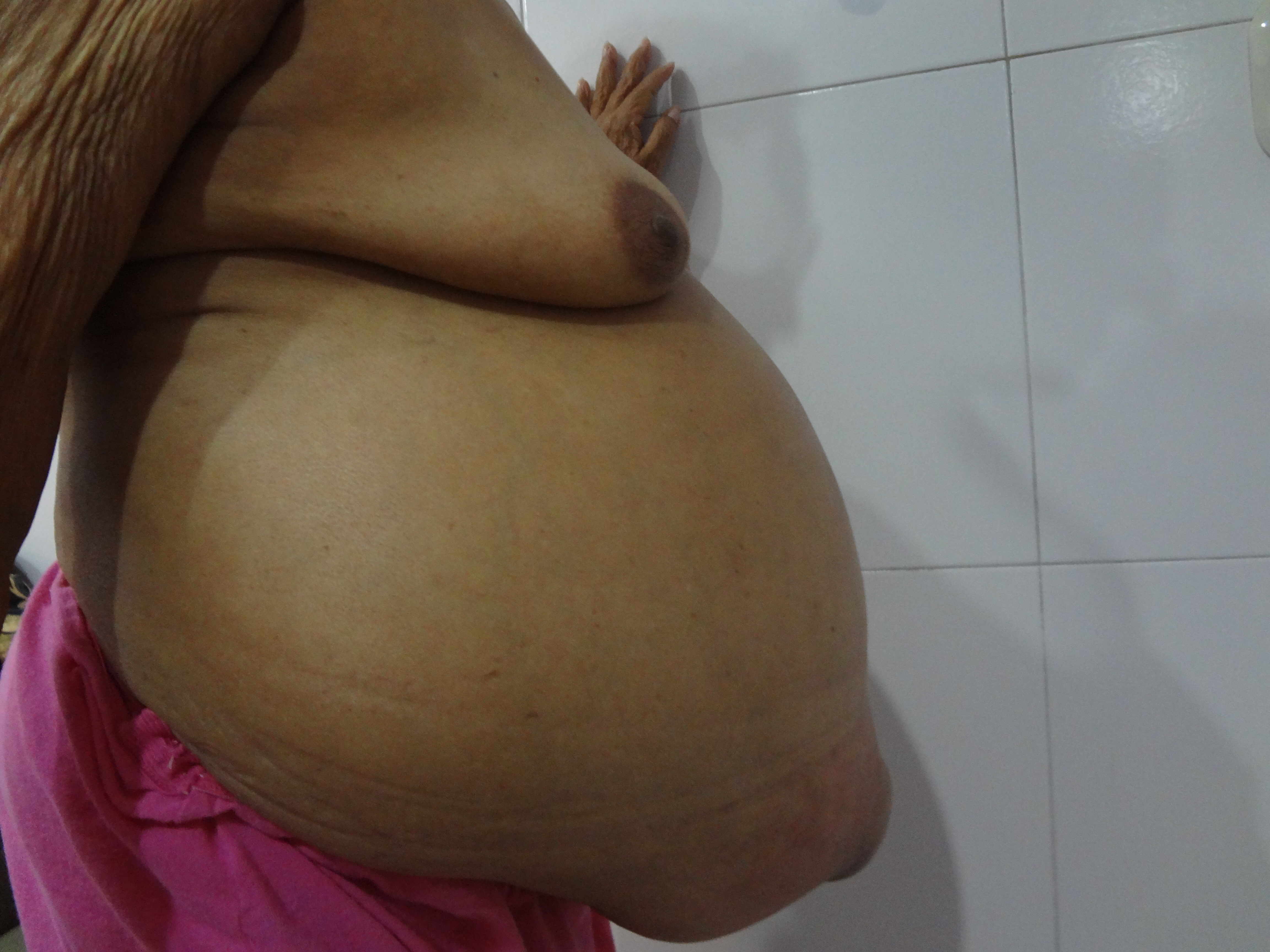 anne tikkanen recommends anal tummy bulge pic