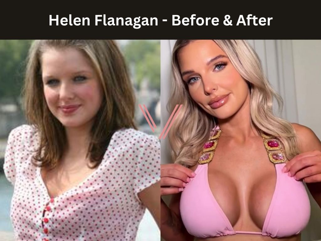 skinny blonde fake tits adult site skinny blonde fake tits