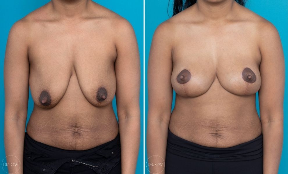 dakotah simpson recommends swiging tits atik maria add swiging tits photo