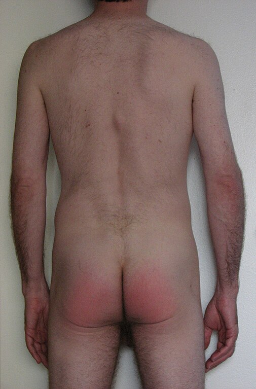 chandra ilham recommends male spanking photos pic