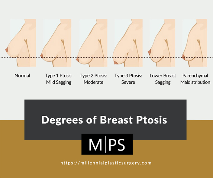 anurag rathi recommends naturally perky tits pic