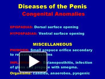 amazing born penis anomaly in girl supermodel - pinky porn star now naughty alyssa