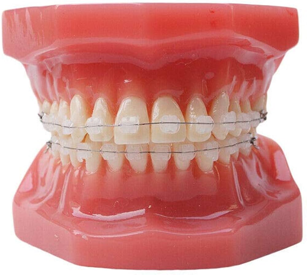 darlene kriz add photo braces facial comp