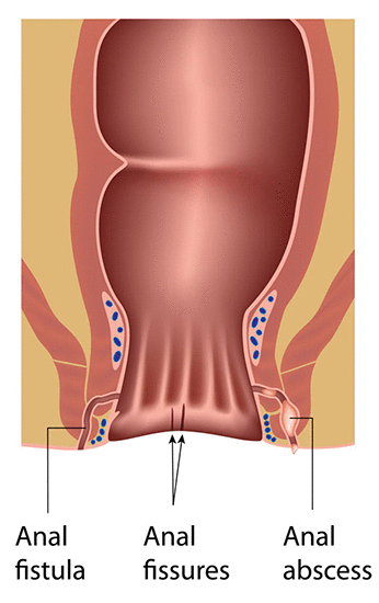 berna buzon recommends First Anal Hurts