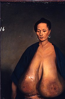 ayie danish recommends Big Boobs Missionary