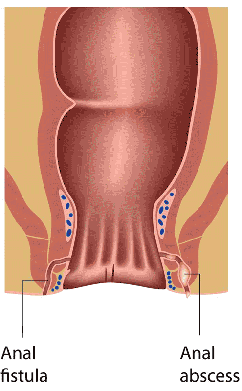 asmaa youssif recommends anal category pic