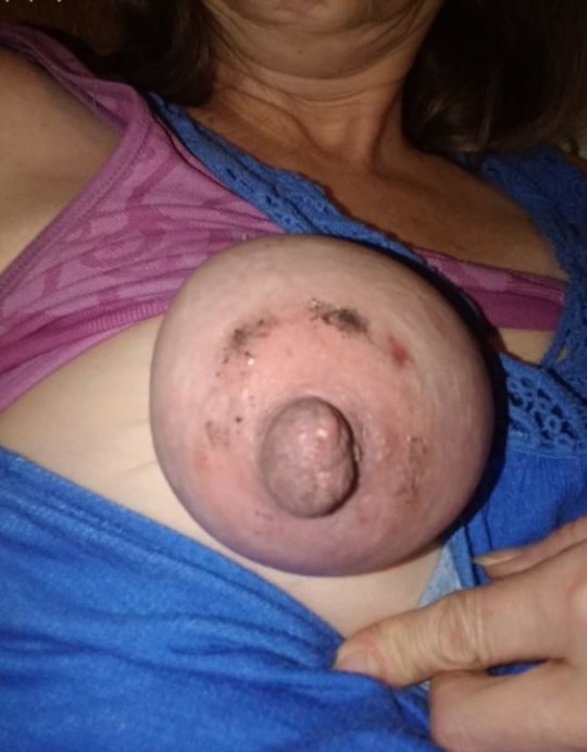 eporn hub