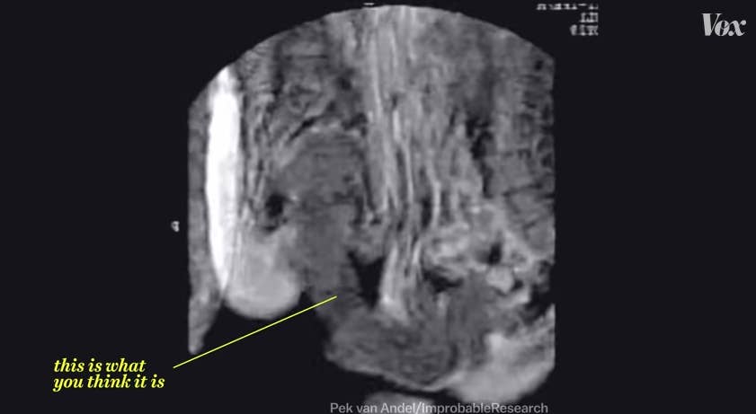 cervix fucking - decollector pornhub sperm hospital porn