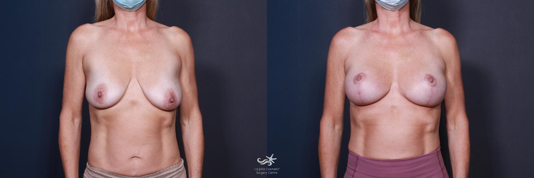 chad vann add photo black perky tits