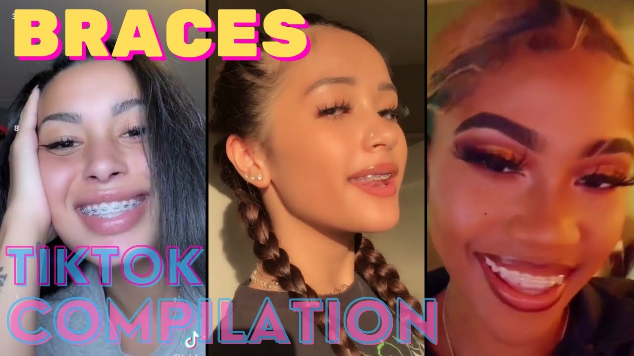 angie willey recommends braces facial comp pic