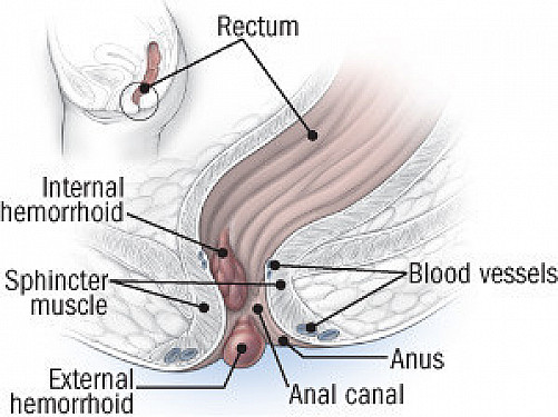 desiree ewell recommends High Def Anal