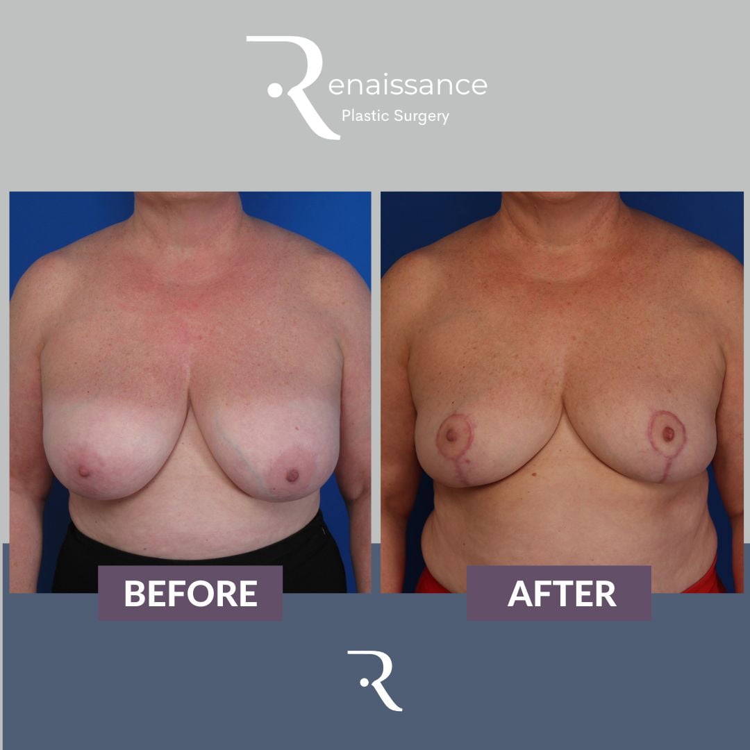 ahmet rasim like ddd tities photo awais ishaq recommends ddd tities pic