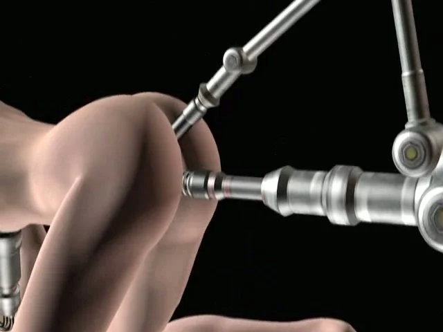 ayie sahaja share extreme bdsm anal photos