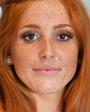alexis winfrey like freckled women naked photo alli fischer recommends freckled women naked pic