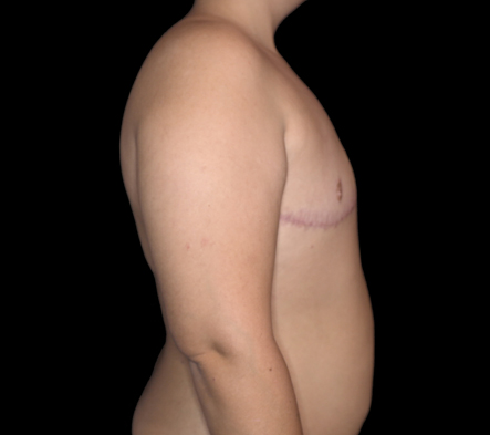 chris ellson recommends ftm nude daan van heerden add ftm nude photo