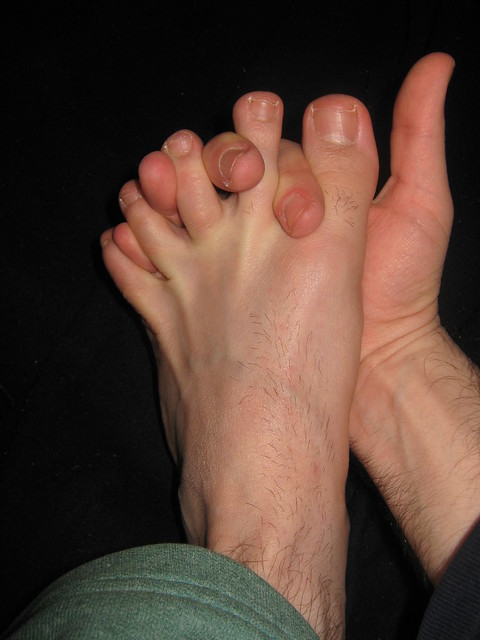 Best of david garen's gallery genshin impact hen tai dana josephson add photo hairy spread legs
