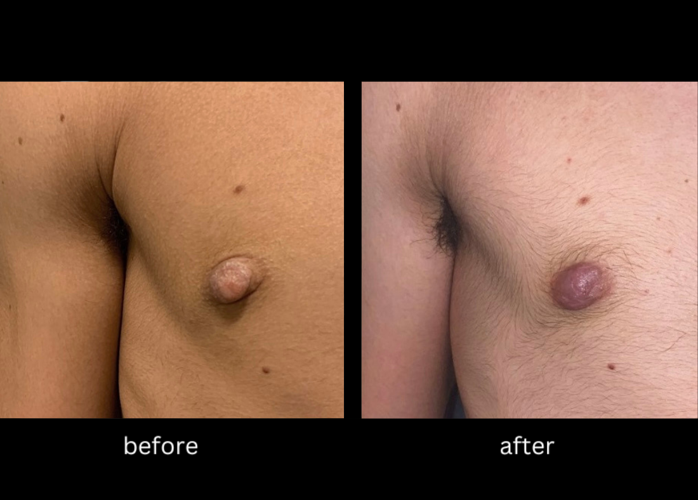 devika paul like long nippled women photo brad sowden recommends long nippled women pic