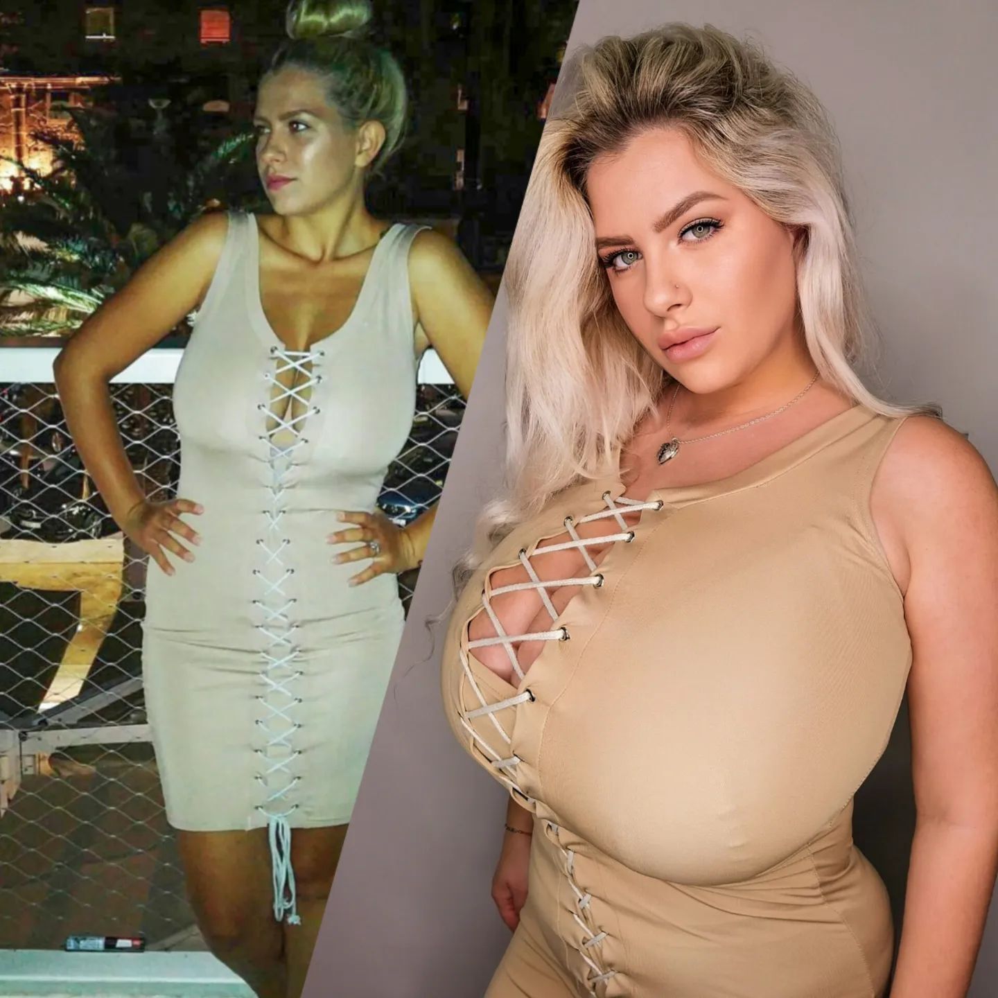 brandon faunce recommends Massive Balloon Tits