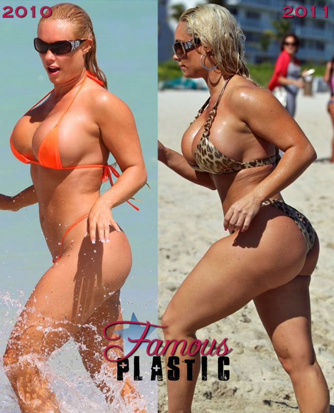 dayan borges add mia malkova surgery photo