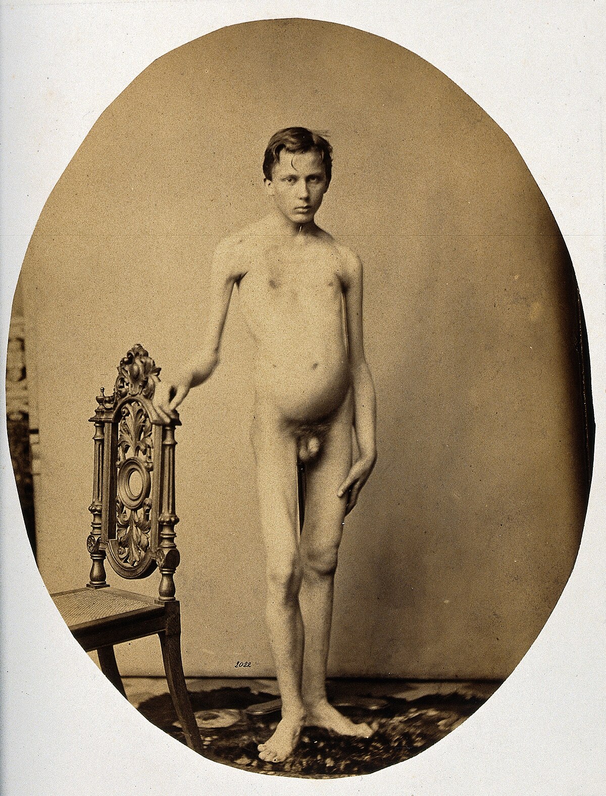 caren corona like naked little men photo brian sanao recommends naked little men pic