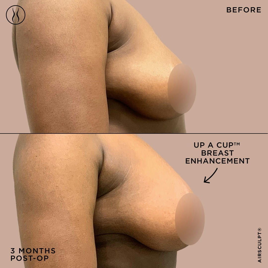 brett salyer like nice natural boobies photo besim selmani recommends nice natural boobies pic