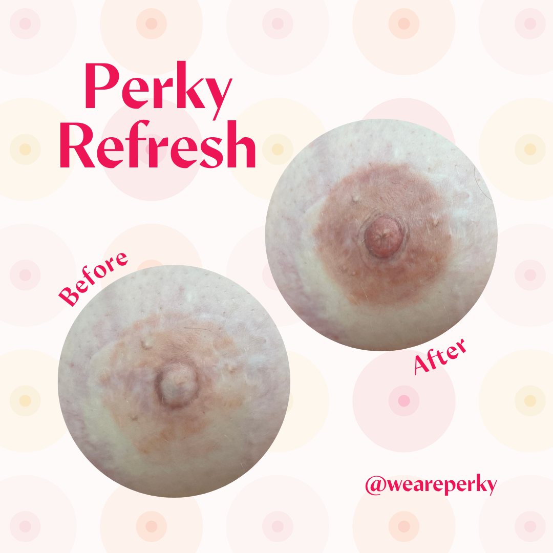 chad kitchen recommends perky niples pic