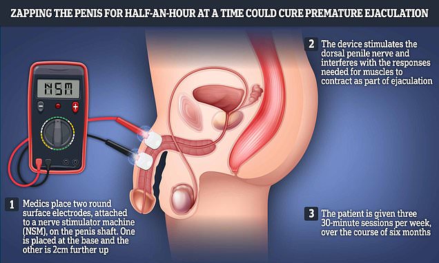 bob probasco like premature ejaculation in mouth photo chris dusenberry recommends premature ejaculation in mouth pic