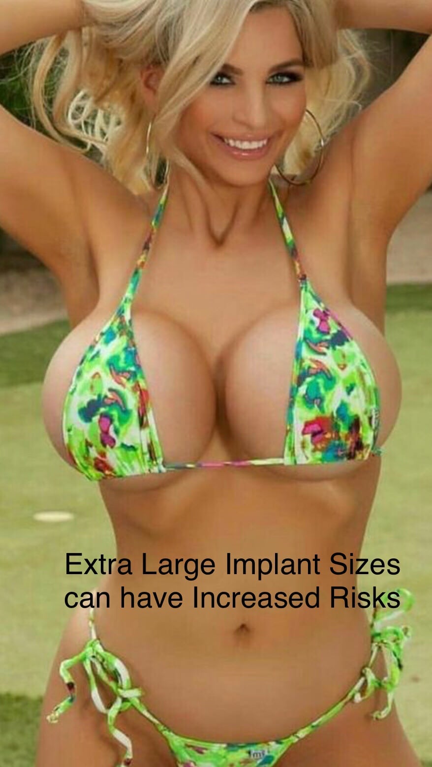 antwan yates like skinny fake tits photo amanda lee peterson recommends skinny fake tits pic