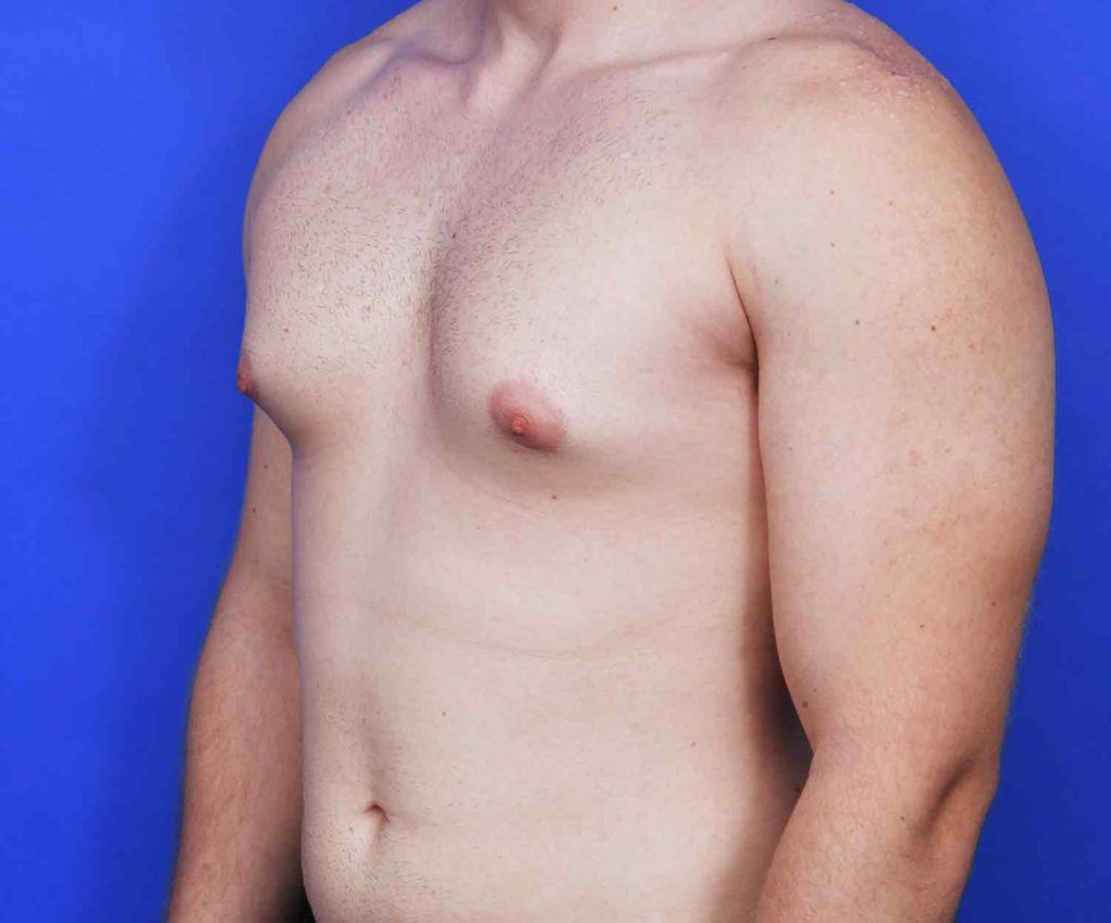 braydon hackett recommends Small Pointy Titties