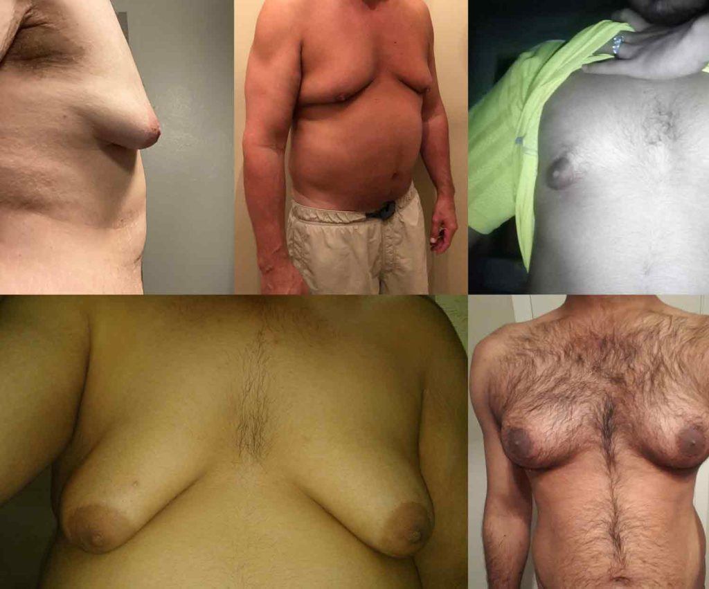 carlo estadilla like small pointy titties photo david a lewellyn recommends small pointy titties pic