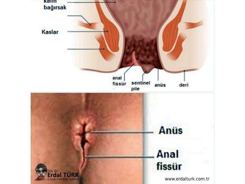 buhari bello recommends Turk Anal