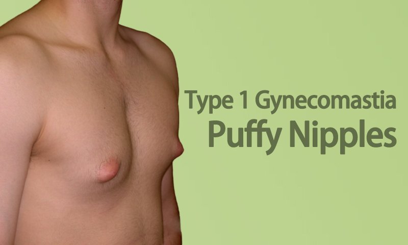 chris vrooman recommends Www Puffynipples Com